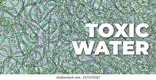 Nostoc Sp. Blue Green Algae Under Microscopic View With Toxic Water Text, Cyanobacteria. Global Pollution Of The Environment And Water Bodies. Water Blooming, Flowering In Summer