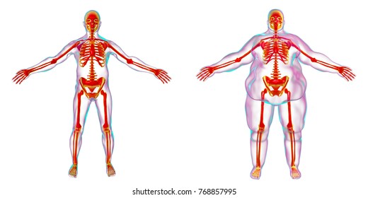 Obesity problem conceptual image, 3D illustration showing normal wieght man and normal skeleton inside obese male body