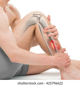 Oblique Fracture of the Tibia - Leg Hurt Anatomy - 3D illustration
