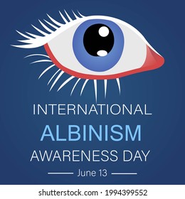 Ocular albinism eyesight symptoms vector illustration. International albinism awareness day template. June 13 albinism awareness day.
