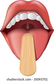 Open mouth and tongue sticking  Mouth is being looked at and the help doctor's wooden  tongue depressor  Adobe Illustrator gradient mesh tool was used  CMYK color 
