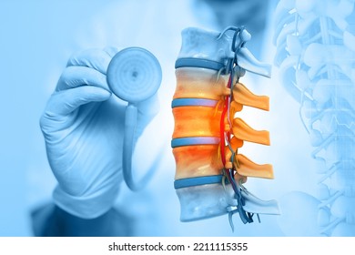 1,092 3d Orthopaedic Images, Stock Photos & Vectors | Shutterstock