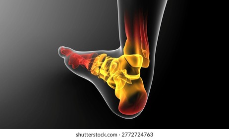 Orthopedic Concept With Sprained Ankle Visualization 3D illustration