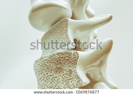 Osteoporosis on the spine - 3d rendering