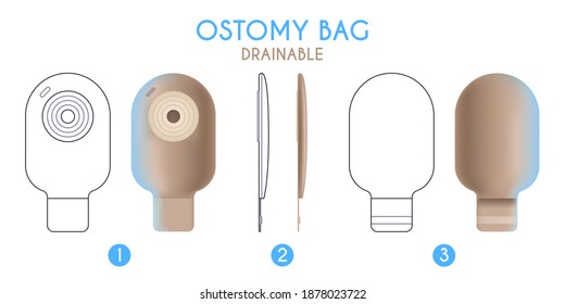 Ostomy bag illustration schematic image