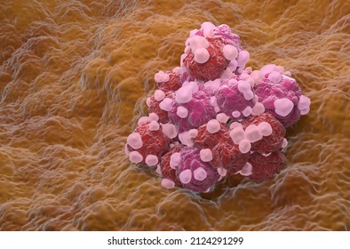 Ovarian Cancer Cell Variations Cluster - Isometric View 3d Illustration