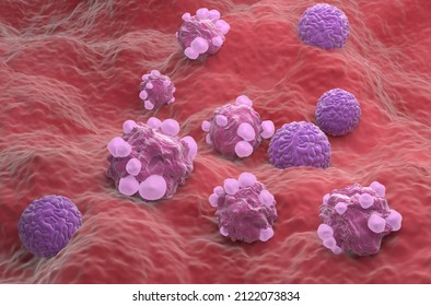 Ovarian cancer cells - isometric view 3d illustration