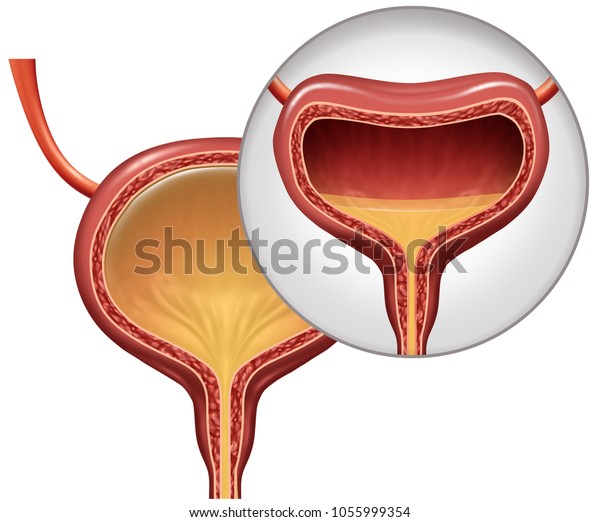 Overactive Bladder Involuntary Loss Urine Concept Stock Illustration ...