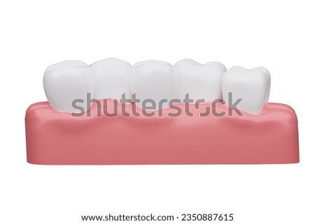 overlapping teeth with gums isolated white background, 3D rendering.