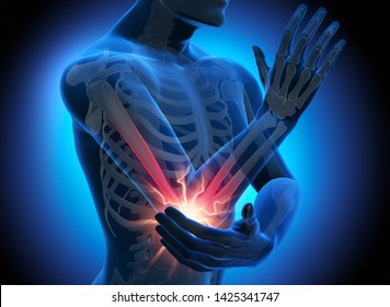 16,829 Elbow pain anatomy Images, Stock Photos & Vectors | Shutterstock