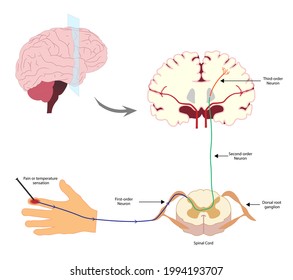 Pain Pathway. Nociception.  Ascending Pathway That Connect The Periphery With The Brain During Pain And Temperature Sensation. Hand, Spinal Cord And Brain. 