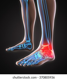 足首 怪我 のイラスト素材 画像 ベクター画像 Shutterstock