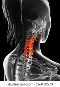 Painful Cervical Spine