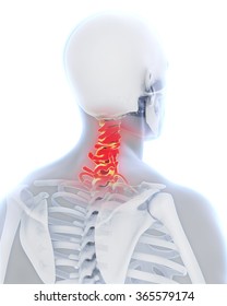 Painful Cervical Spine