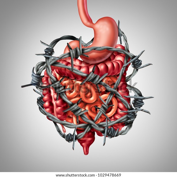 Painful\
digestion IBS or irritable bowel syndrome and intestine pain or\
Intestinal discomfort inflammation problem or constipation as\
barbed wire with 3D illustration\
elements.