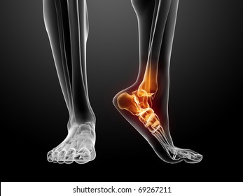 painful foot illustration
