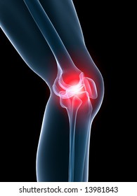 12,610 Knee pain 3d Images, Stock Photos & Vectors | Shutterstock