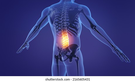 Painful Lumbar Spine. 3d Illustration.