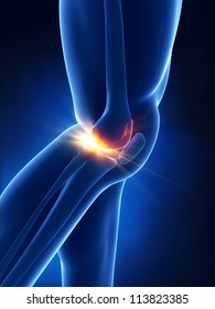 Painful meniscus concept
