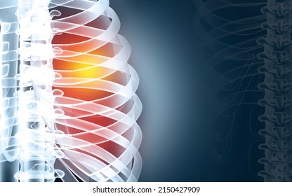 Painful Rib Anatomy, Fractured Ribs, Pain Highlighted In Glowing Red. 3d Illustration