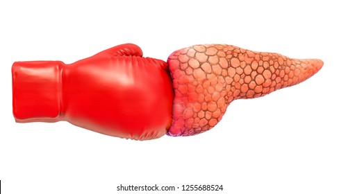 Pancreatic Pain. Pancreas With Boxing Glove. 3D Rendering Isolated On White Background