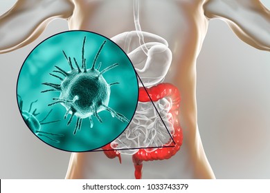 Parasitic infection of intestine, 3D illustration showing close-up view of an abstract parasite and anatomy of human digestive system Stock Illustration