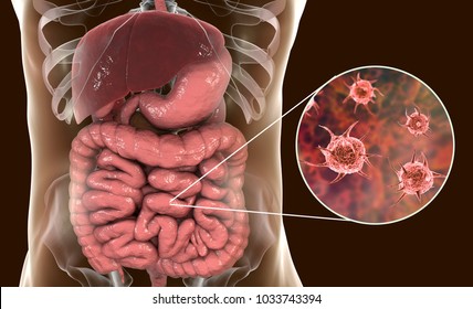 Parasitic infection of intestine, 3D illustration showing close-up view of an abstract parasite and anatomy of human digestive system Stock Illustration