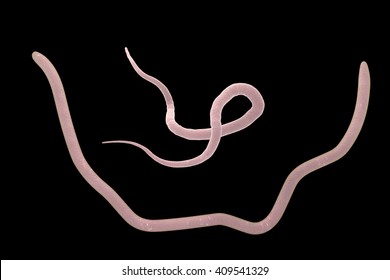 Parasitic Nematode Worms Roundworms Ascaris Lumbricoides Male