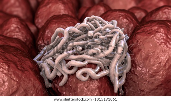 腸に寄生虫 3dイラスト 虫食い虫と他の丸虫 のイラスト素材