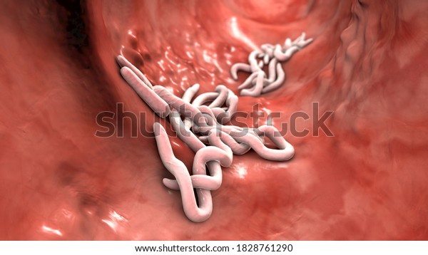 Parasitic worms in the lumen of intestine, 3D\
illustration. Ascaris lumbricoides, Enterobius vermicularis, and\
other round\
worms
