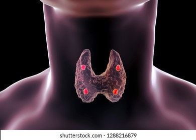 Parathyroid glands and thyroid gland anatomy, 3D illustration