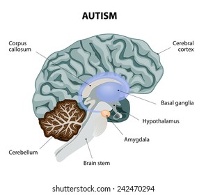 Parts of the brain affected by autism. Medical illustration