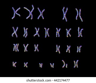 Patau-syndrome Karyotype, Male Or Female, Unlabeled. Trisomy 13. 3D Illustration