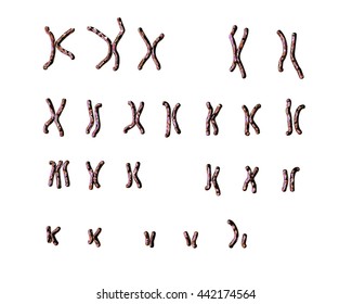 Patau-syndrome Male Karyotype, Unlabeled. Trisomy 13. 3D Illustration