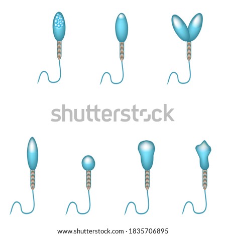 Pathological forms of sperm in the ejaculate. Male infertility Oligospermia. Spermogram. Pathology of the head. Sperm defects. Infographics. illustration on isolated background
