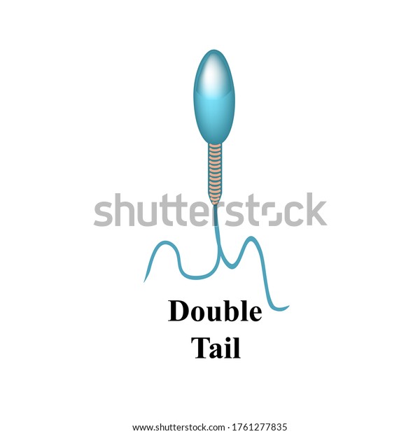 Pathological Forms Sperm Ejaculate Male Infertility Stock Illustration