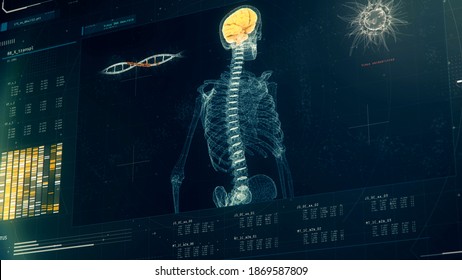 Patient's Brain Scan Results On Screen, DNA Mutation, Virus Detection, Forensics. Medical Software Interface With DNA Scan Results, Anomaly Detected, Lab Equipment, Mri. 3D Illustration