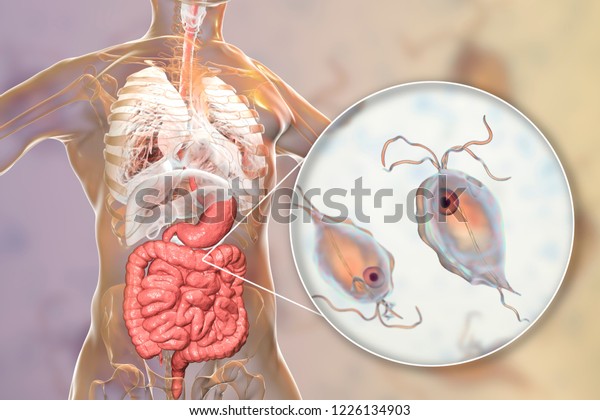 pentatrichomonas hominis o que e
