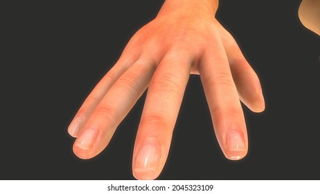 Pernicious Anemia Symptoms In Hand.3d Illustration