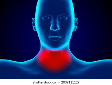 Pharyngitis is an infection of the pharynx caused by bacteria of the genus Streptococcus. 3D rendering