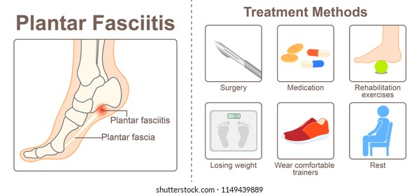 Plantar Fascia And Treatment Methods