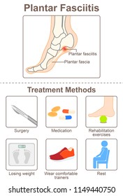 Plantar Fascia And Treatment Methods