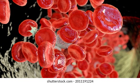 Polycythemia Vera, A Rare Slow-growing Blood Cancer With An Increase In The Number Of Red Blood Cells In The Body, 3D Illustration Showing Abundant Erythrocytes Inside Blood Vessel