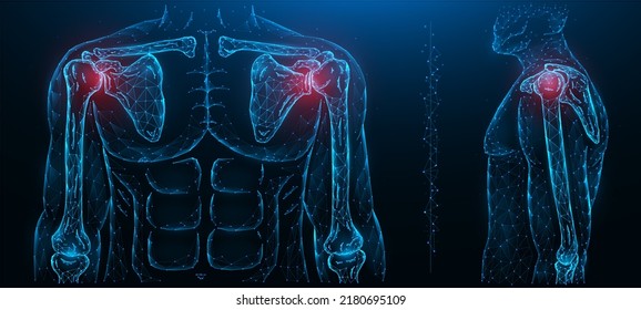 Polygonal Vector Illustration Of A Painful Shoulder Joint. Shoulder Joint Disease. Diseases Of The Human Musculoskeletal System