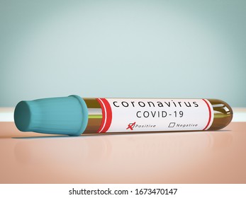 Positive blood test tube result for covid-19 coronavirus, epidemic of coronavirus disease 2019-2020. COVID-19, caused by the SARS-CoV-2 virus