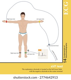 The positive electrode of the aVF lead is the left lower limb electrode, and the negative electrode is the Goldberger central electrode, which explores the electrical activity of the heart in the lower left region.