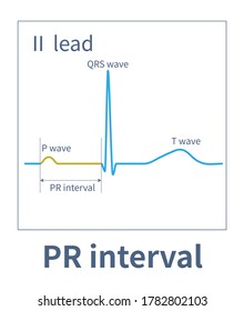 82 Pr interval Images, Stock Photos & Vectors | Shutterstock