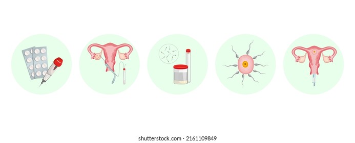 Procedure Artificial Insemination Egg Fertilization Sequence Stock ...