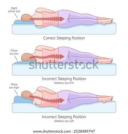 proper and improper side sleeping positions with spine alignment, the effects of pillow height and mattress firmness diagram hand drawn raster illustration. Medical science educational illustration