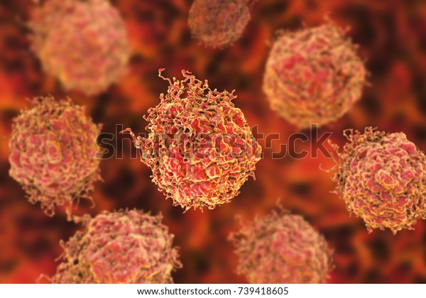 Prostate cancer cells, 3D illustration. Prostate\
cancer awareness\
image